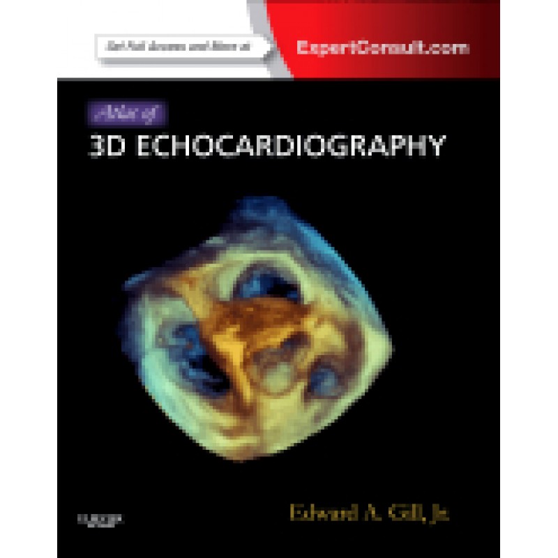Atlas of 3D Echocardiography Expert Consult – Online and Print